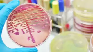 Esta bacteria es resistente a varios antibióticos