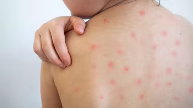 Con medidas preventivas se reduce la posibilidad de contagiarse