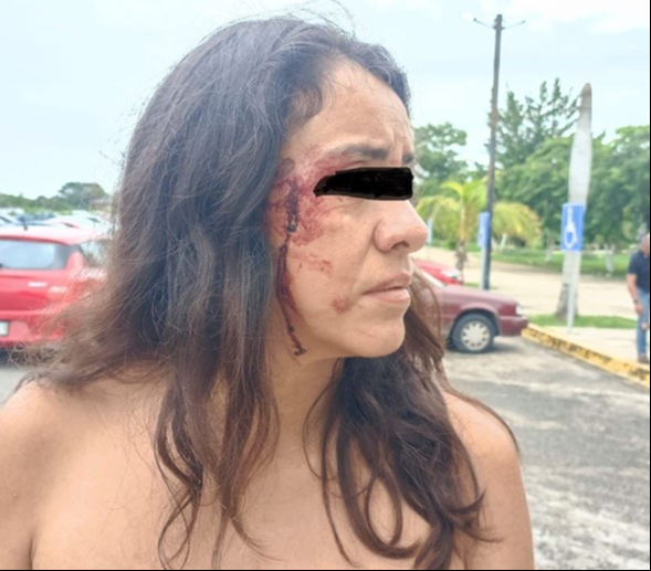 La agresión ocurrió durante una discusión sobre el cuidado de su madre y la instalación de cámaras La agresión ocurrió durante una discusión sobre el cuidado de su madre y la instalación de cámaras
