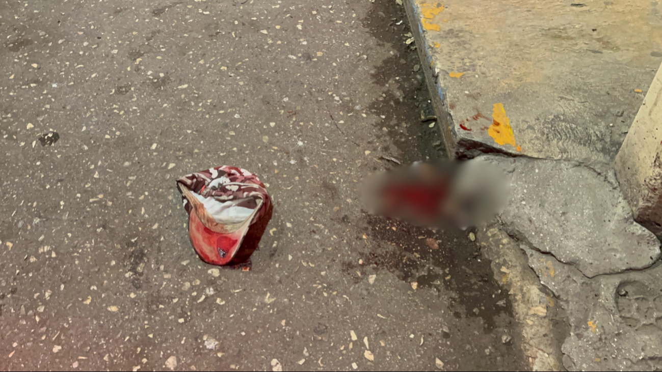 La herida fue causada por una caída debido al estado etílico del individuo, no por agresión La herida fue causada por una caída debido al estado etílico del individuo, no por agresión