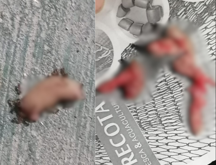 Un menor en Isla Arena sufrió la mutilación de tres dedos y la ruptura de tímpanos por un artículo pirotécnic Un menor en Isla Arena sufrió la mutilación de tres dedos y la ruptura de tímpanos por un artículo pirotécnic