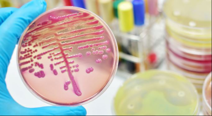 Esta bacteria es resistente a varios antibióticos