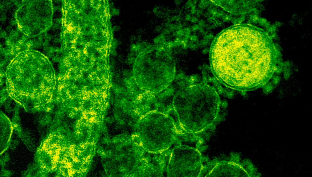 Estos son los síntomas principales de la bacteria Klebsiella Oxytoca