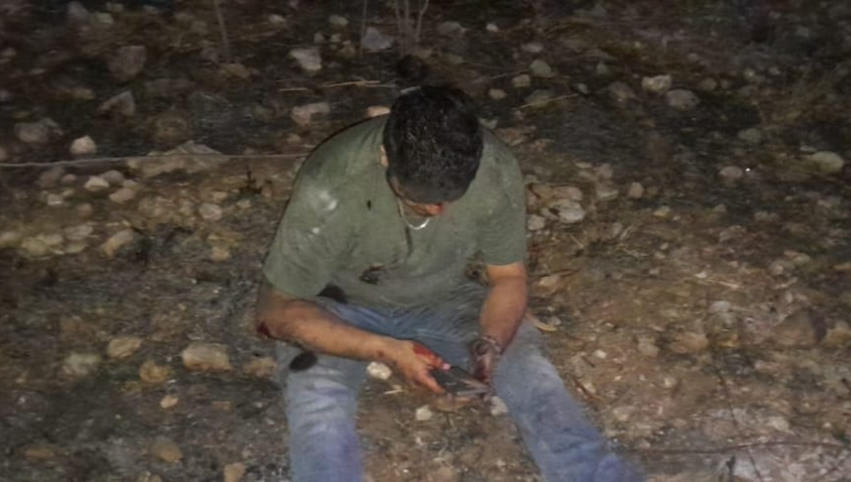 El motociclista herido fue trasladado al hospital de Motul El motociclista herido fue trasladado al hospital de Motul