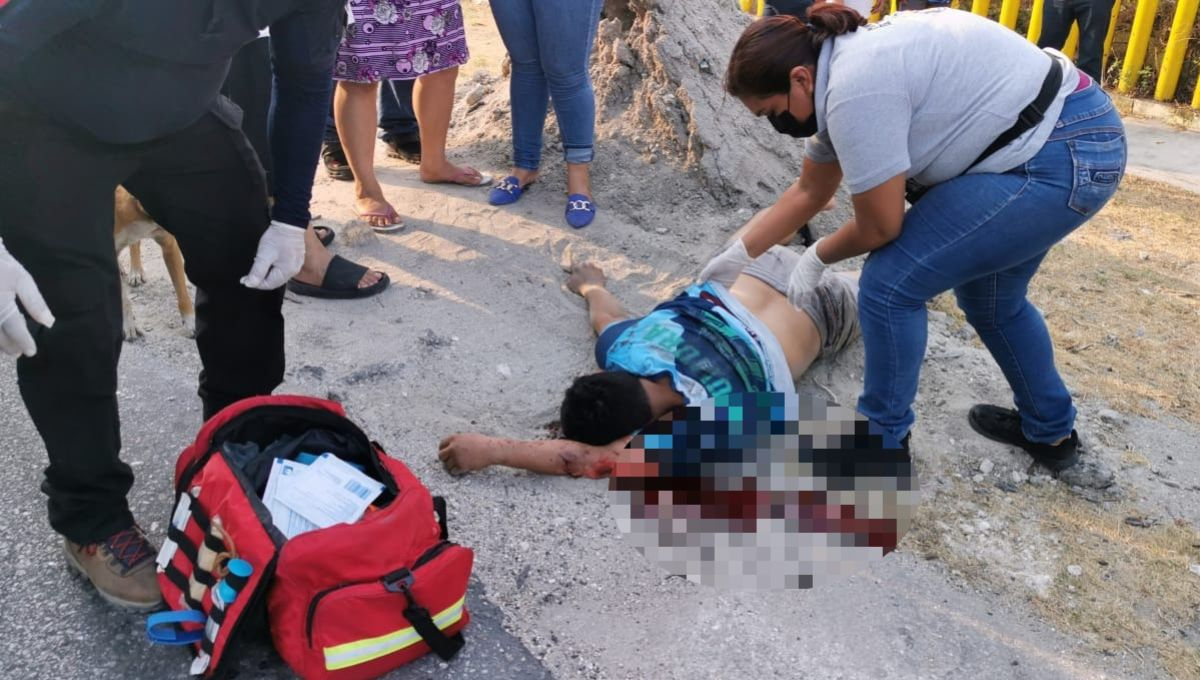 Motociclista termina con el rostro desfigurado tras derrapar en Ciudad del Carmen 