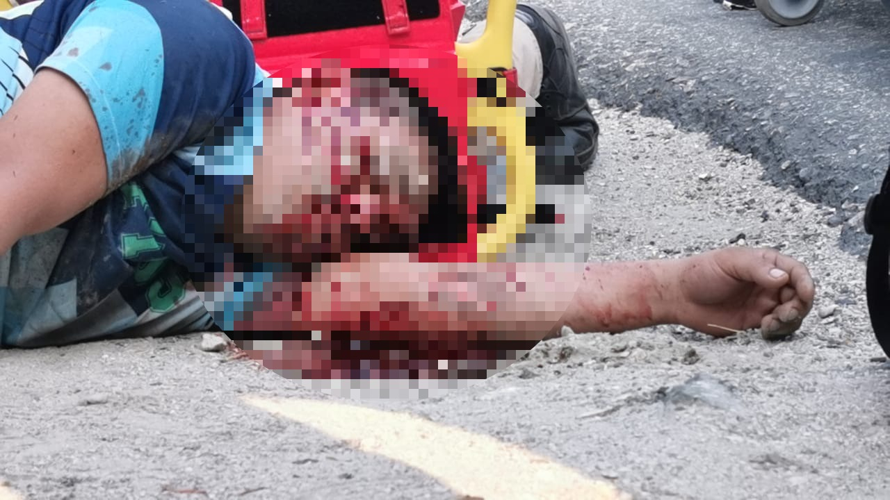 Hombre resultó con lesiones graves en el rostro en Ciudad del Carmen Hombre resultó con lesiones graves en el rostro en Ciudad del Carmen