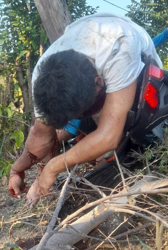 Paramédicos no pudieron salvar la vida del hombre en Campeche Paramédicos no pudieron salvar la vida del hombre en Campeche