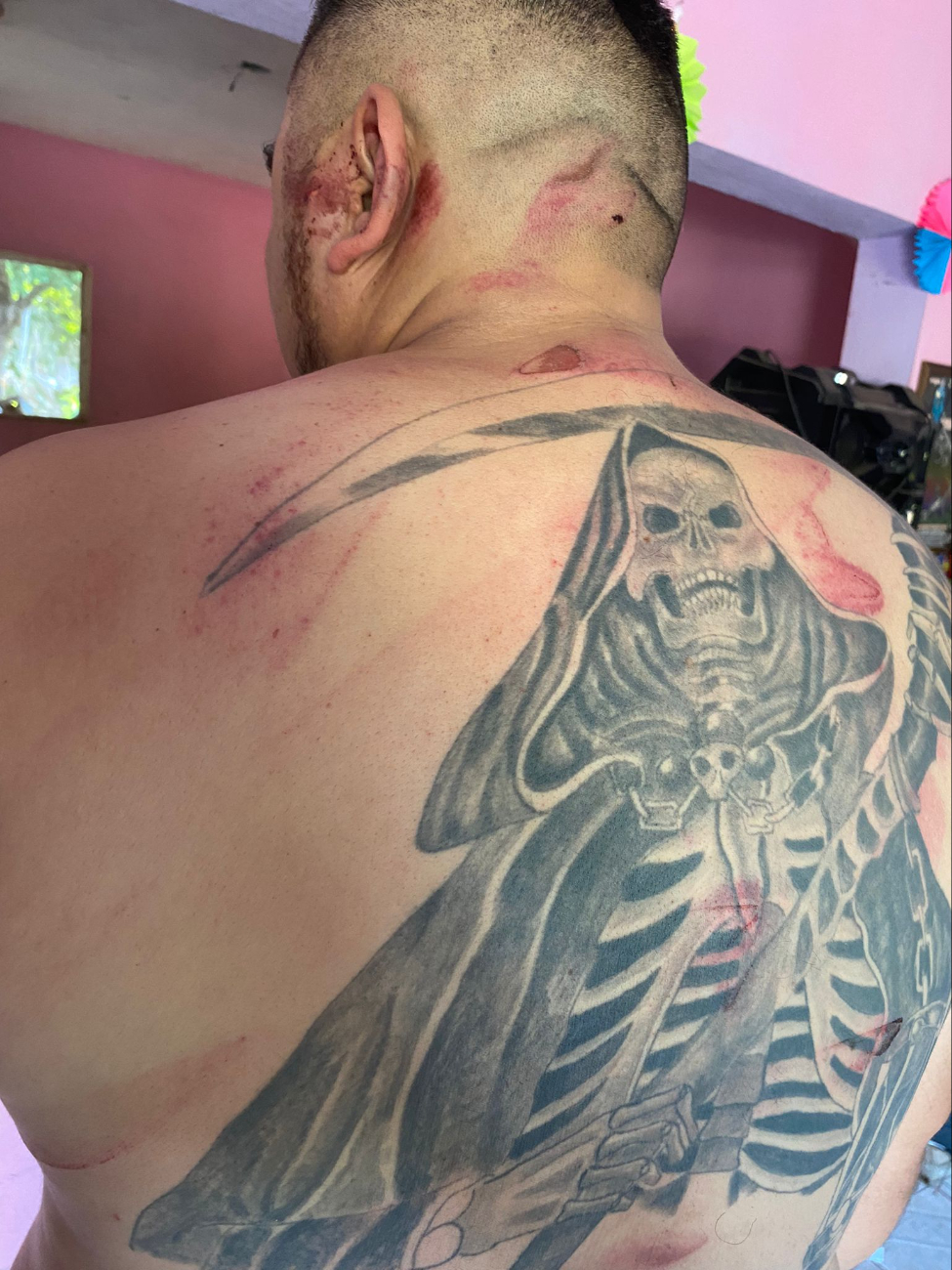 El hombre presentó graves heridas en el cuerpo El hombre presentó graves heridas en el cuerpo