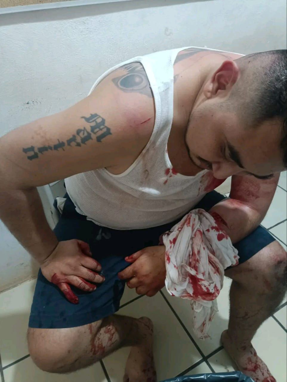 El parte médico 24/7 refirió que el afectado resultó con traumatismo en la cabeza. El parte médico 24/7 refirió que el afectado resultó con traumatismo en la cabeza.