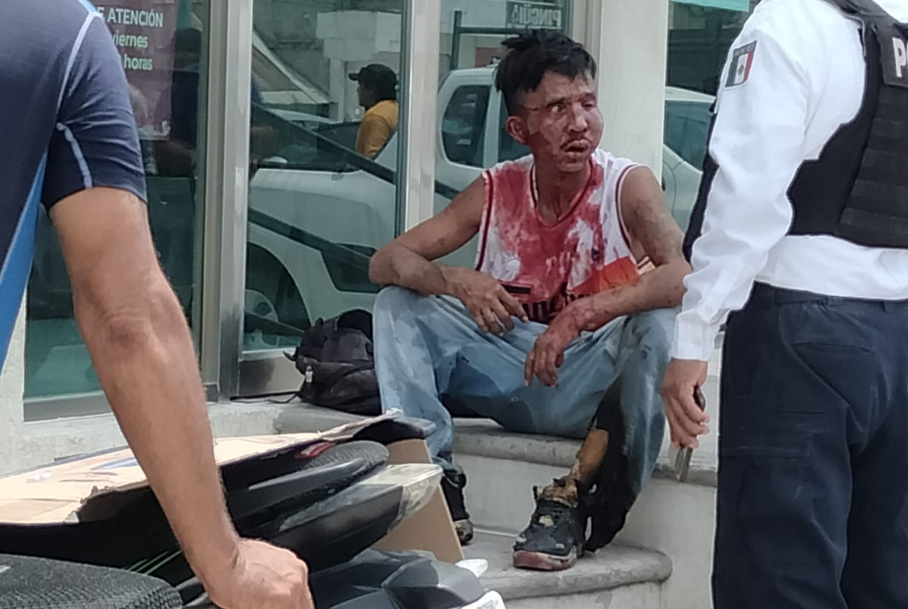 Golpean e intentan quemar vivo a franelero. Golpean e intentan quemar vivo a franelero.