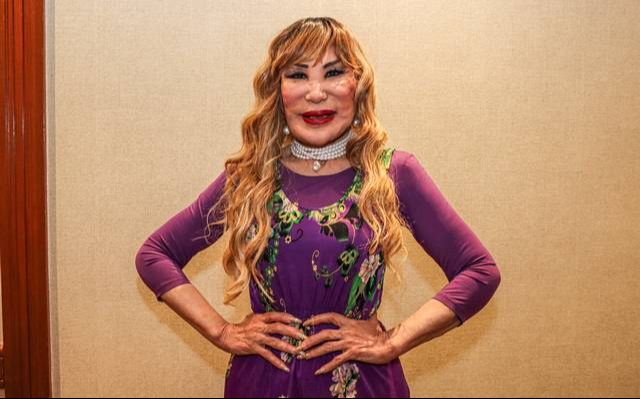 Lyn May asegura que se someterá a una nueva cirugía de rostro Lyn May asegura que se someterá a una nueva cirugía de rostro