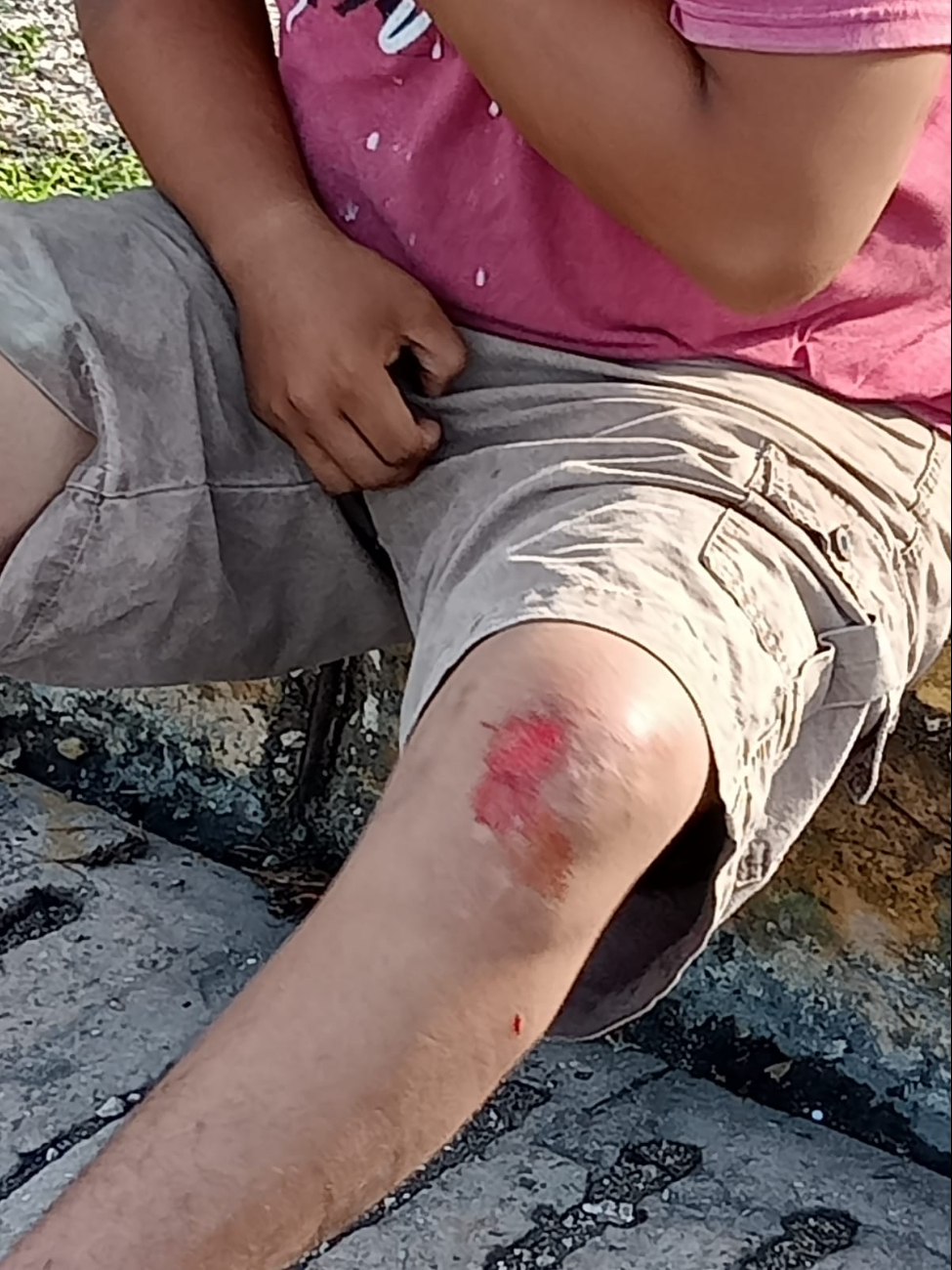 Los paramédicos de la Cruz Roja Mexicana atendieron a los lesionados, quienes presentaban golpes y escoriaciones sangrantes. Los paramédicos de la Cruz Roja Mexicana atendieron a los lesionados, quienes presentaban golpes y escoriaciones sangrantes.