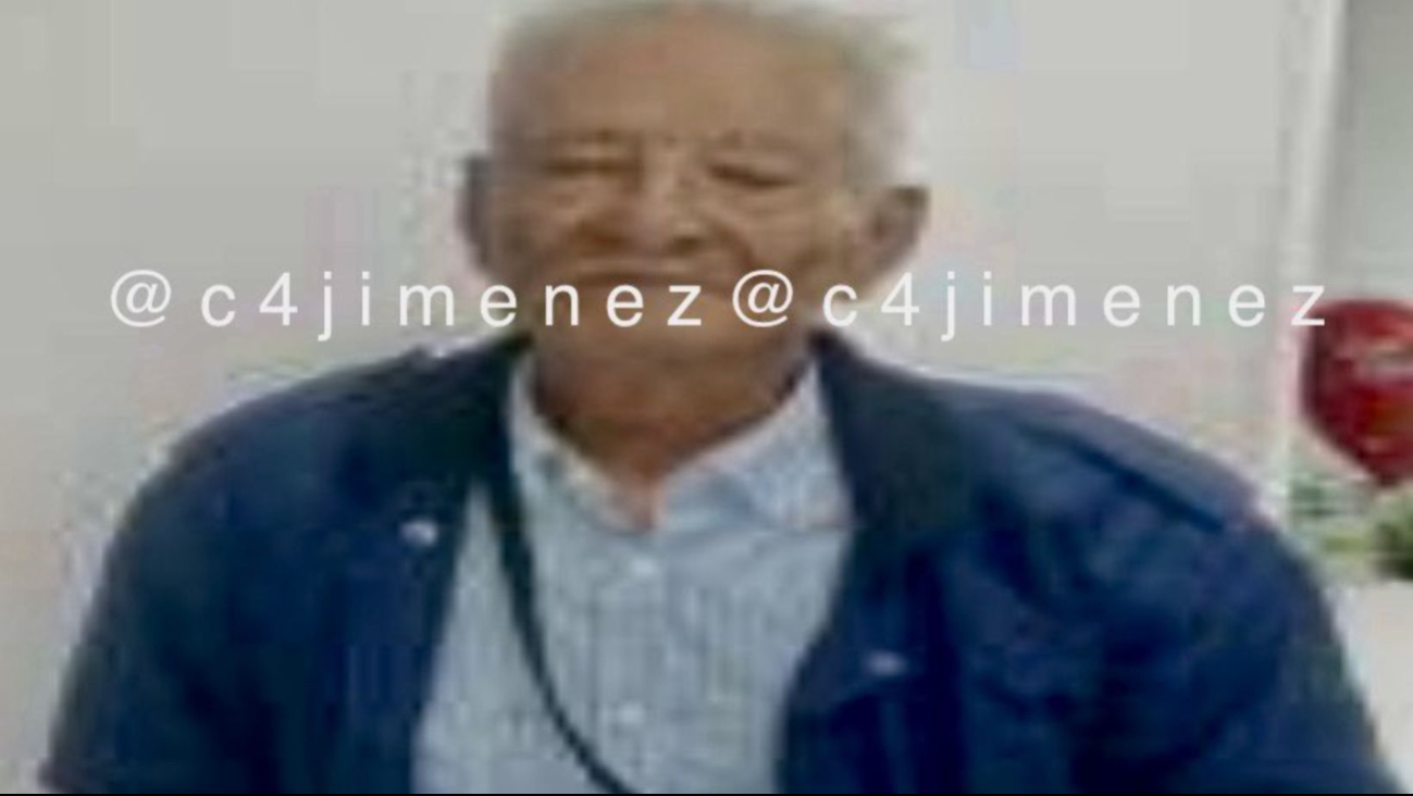 Abuelito prende fuego a su nieta y es detenido en Iztapalapa