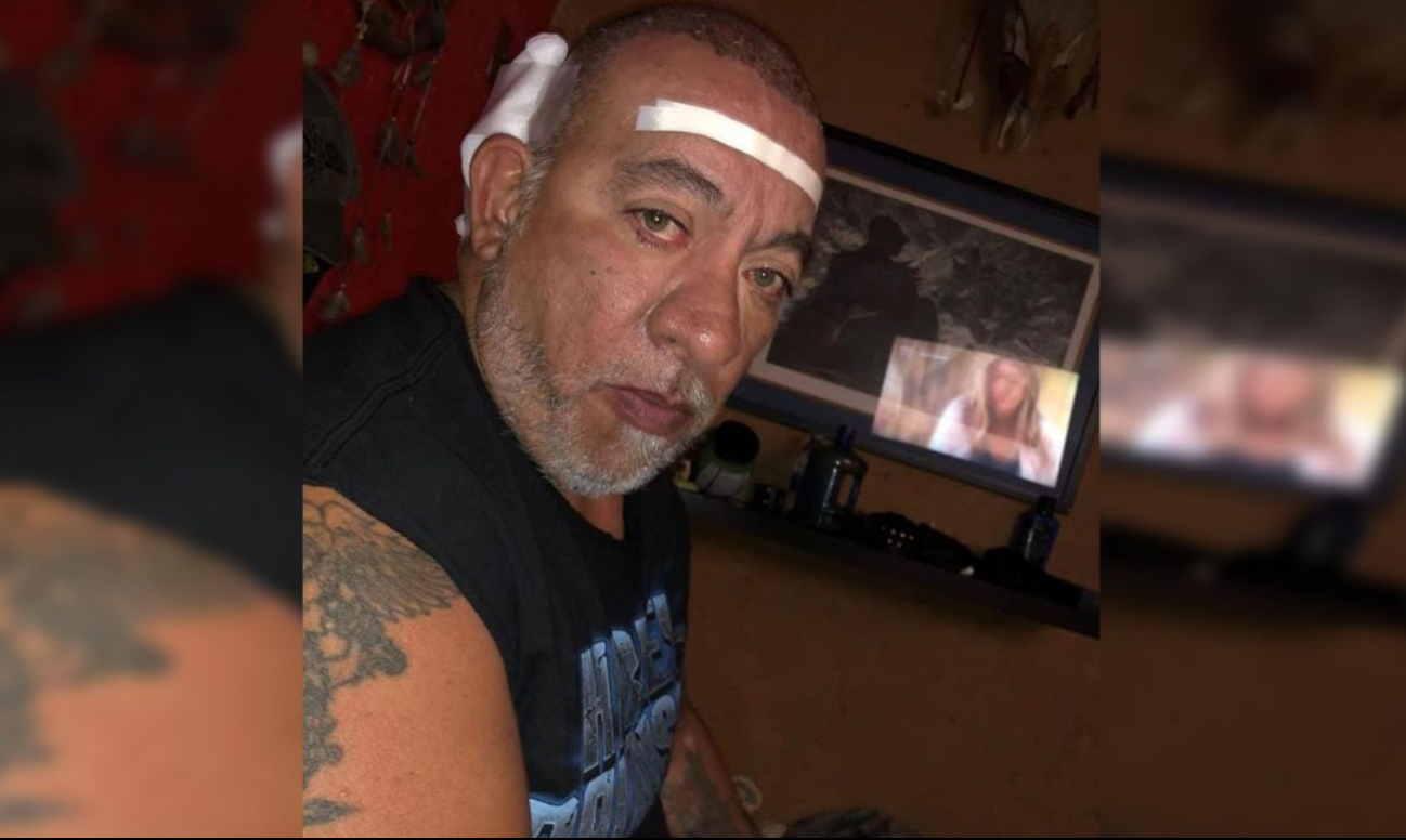 Carlos Trejo es hospitalizado: ¿Cuál es su estado actual de salud Carlos Trejo es hospitalizado: ¿Cuál es su estado actual de salud