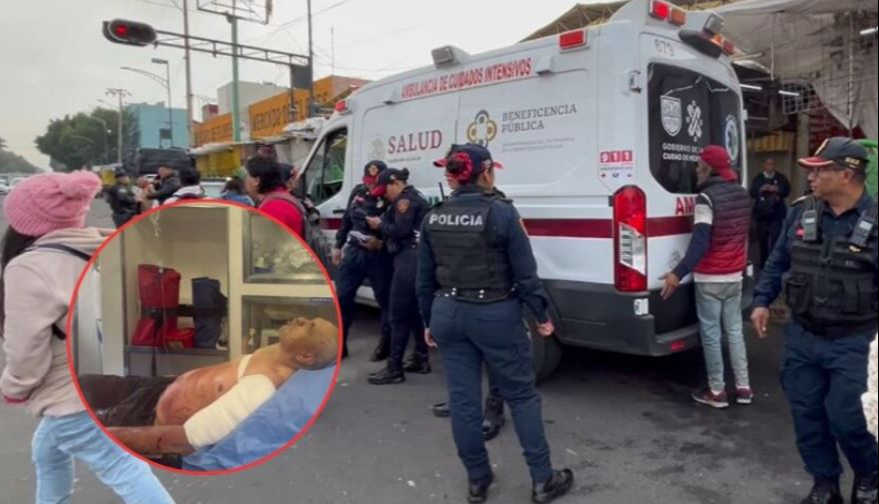 Con machete lesionan a abuelito Con machete lesionan a abuelito