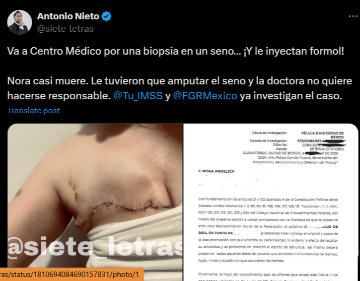 Mujer denuncia negligencia médica luego de que le amputaron el seno / Web Mujer denuncia negligencia médica luego de que le amputaron el seno / Web