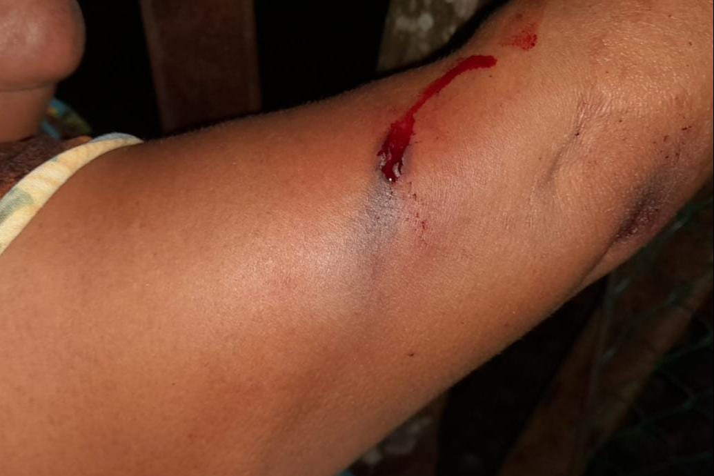 Hombres a bordo de una motocicleta balean domicilio Hombres a bordo de una motocicleta balean domicilio