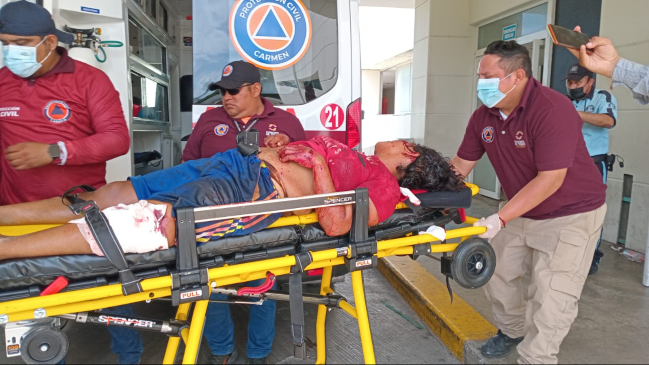 Mujer recibe 4 impactos con arma de fuego en Campeche Mujer recibe 4 impactos con arma de fuego en Campeche
