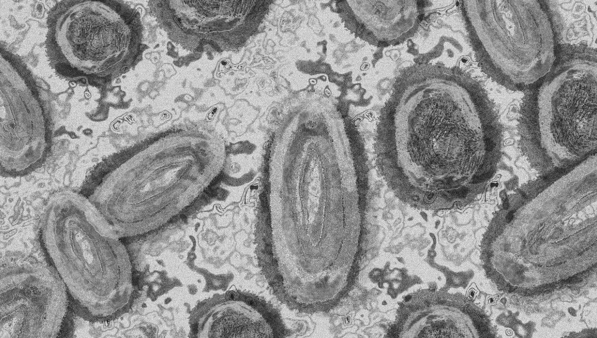 México reporta 212 casos probables y 49 confirmados de mpox en 2024