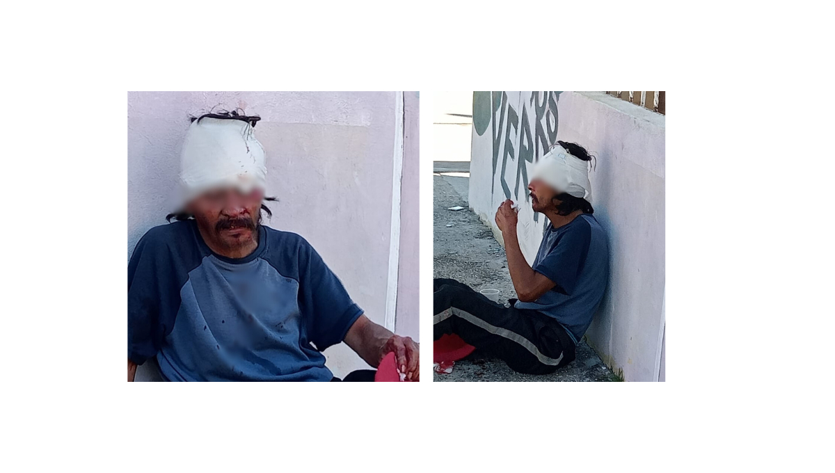 Vecinos llamaron al 911 al verlo herido en la banqueta; el asaltante le robó sus pertenencias y huyó. Vecinos llamaron al 911 al verlo herido en la banqueta; el asaltante le robó sus pertenencias y huyó.