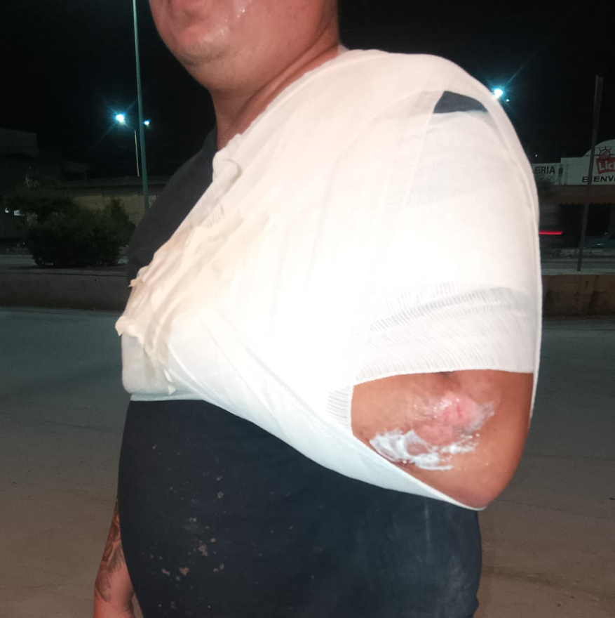La conductora de la camioneta se dio a la fuga sin auxiliar al motociclista, quien sufrió lesiones en el codo, golpes y raspones. La conductora de la camioneta se dio a la fuga sin auxiliar al motociclista, quien sufrió lesiones en el codo, golpes y raspones.