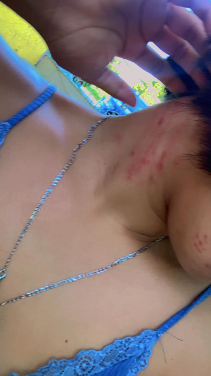 Abigail “N” subió las fotografías de sus lesiones para dar a conocer su caso Abigail “N” subió las fotografías de sus lesiones para dar a conocer su caso