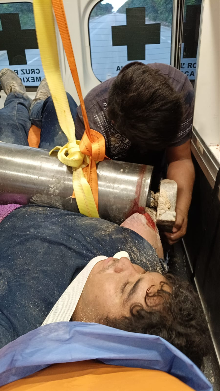 Trabajador del Tren Maya accidenta su brazo en trituradora de piedras 