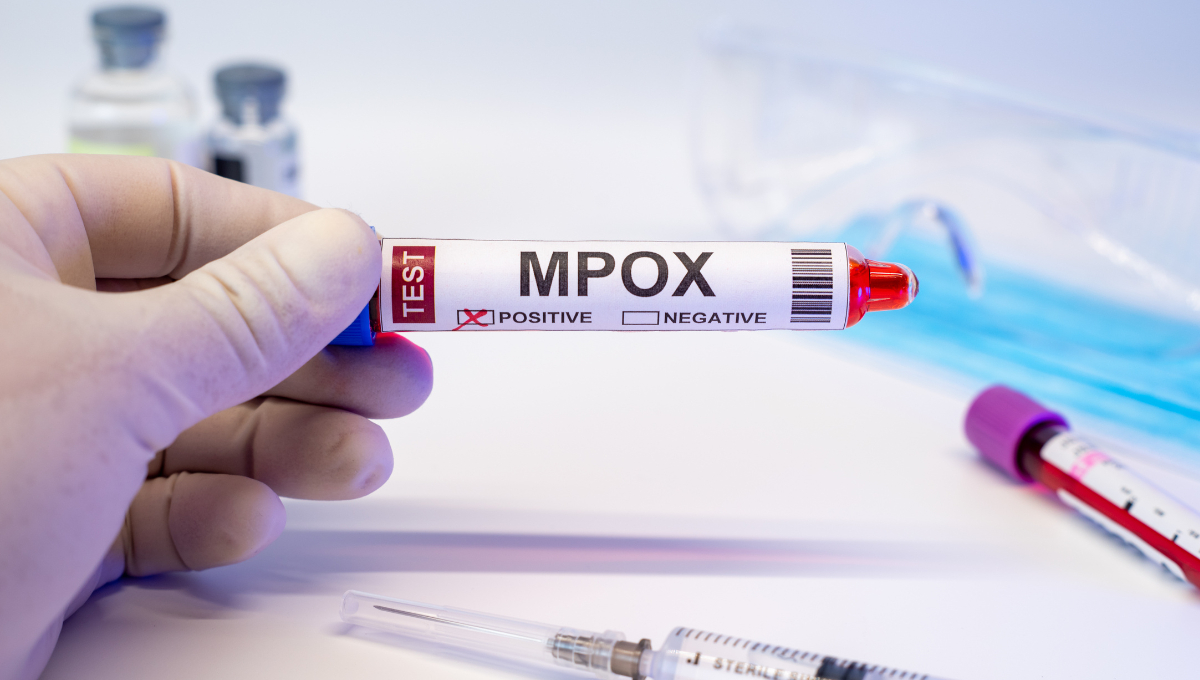 México no cuenta con una vacuna específica ni tratamientos dirigidos para el mpox; el manejo se enfoca en aliviar síntomas. México no cuenta con una vacuna específica ni tratamientos dirigidos para el mpox; el manejo se enfoca en aliviar síntomas.