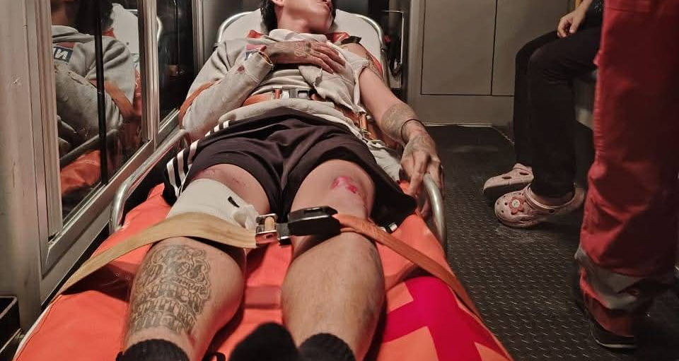 El conductor de la moto sufrió contusiones y posibles fracturas.