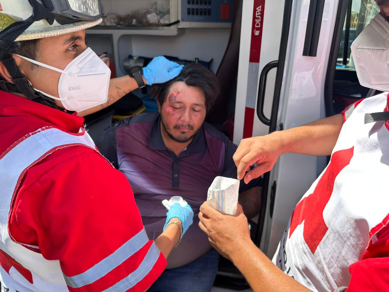Motociclista repartidor resulta lesionado tras ser impactado por un automóvil