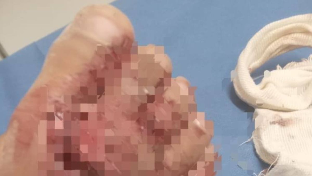 Menor de dos años es afectado por problemas familiares; mientras sus padres pelean por dinero, él se encuentra en espera de una cirugía Menor de dos años es afectado por problemas familiares; mientras sus padres pelean por dinero, él se encuentra en espera de una cirugía