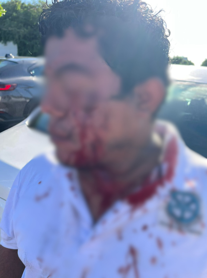 Paramédicos brindaron atención médica al taxista Paramédicos brindaron atención médica al taxista