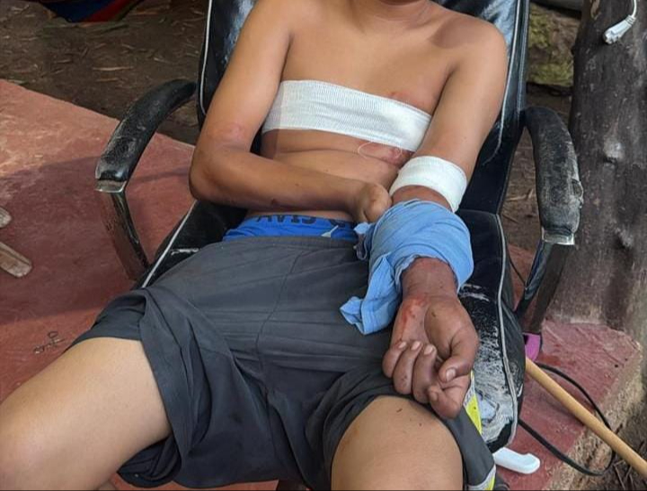 El adolescente dio  diferentes versiones  de lo que ocurrió a  las autoridades El adolescente dio  diferentes versiones  de lo que ocurrió a  las autoridades