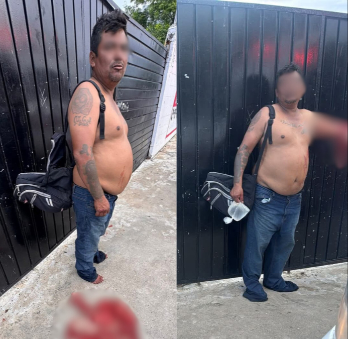 Pese a que se intentó su traslado al hospital, el hombre se negó Pese a que se intentó su traslado al hospital, el hombre se negó