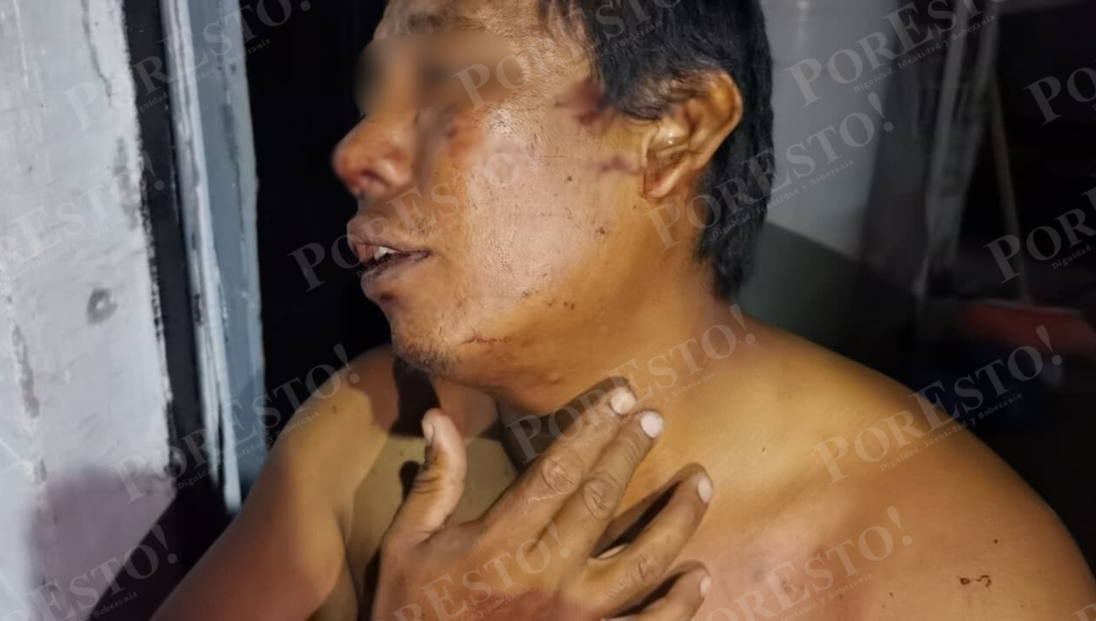 Los agresores escaparon antes del arribo de autoridades, mientras la víctima anunció que denunciará ante la Fiscalía General del Estado.