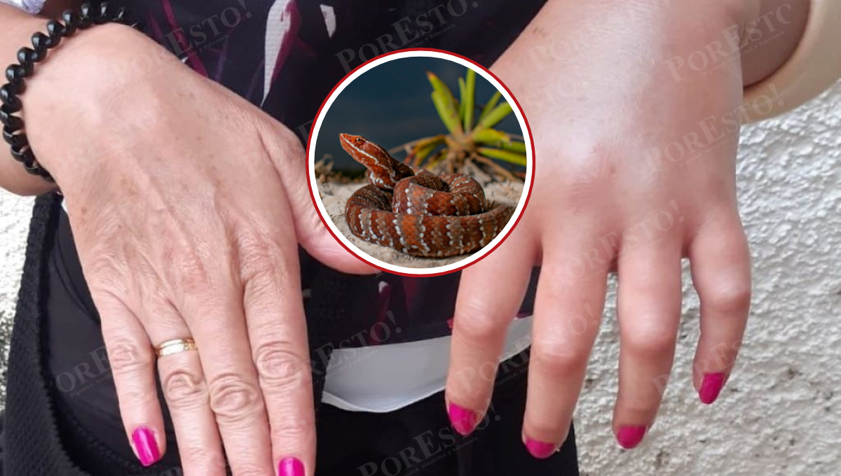 Antivenenos de Birmex y Silanes salvan vidas en Campeche