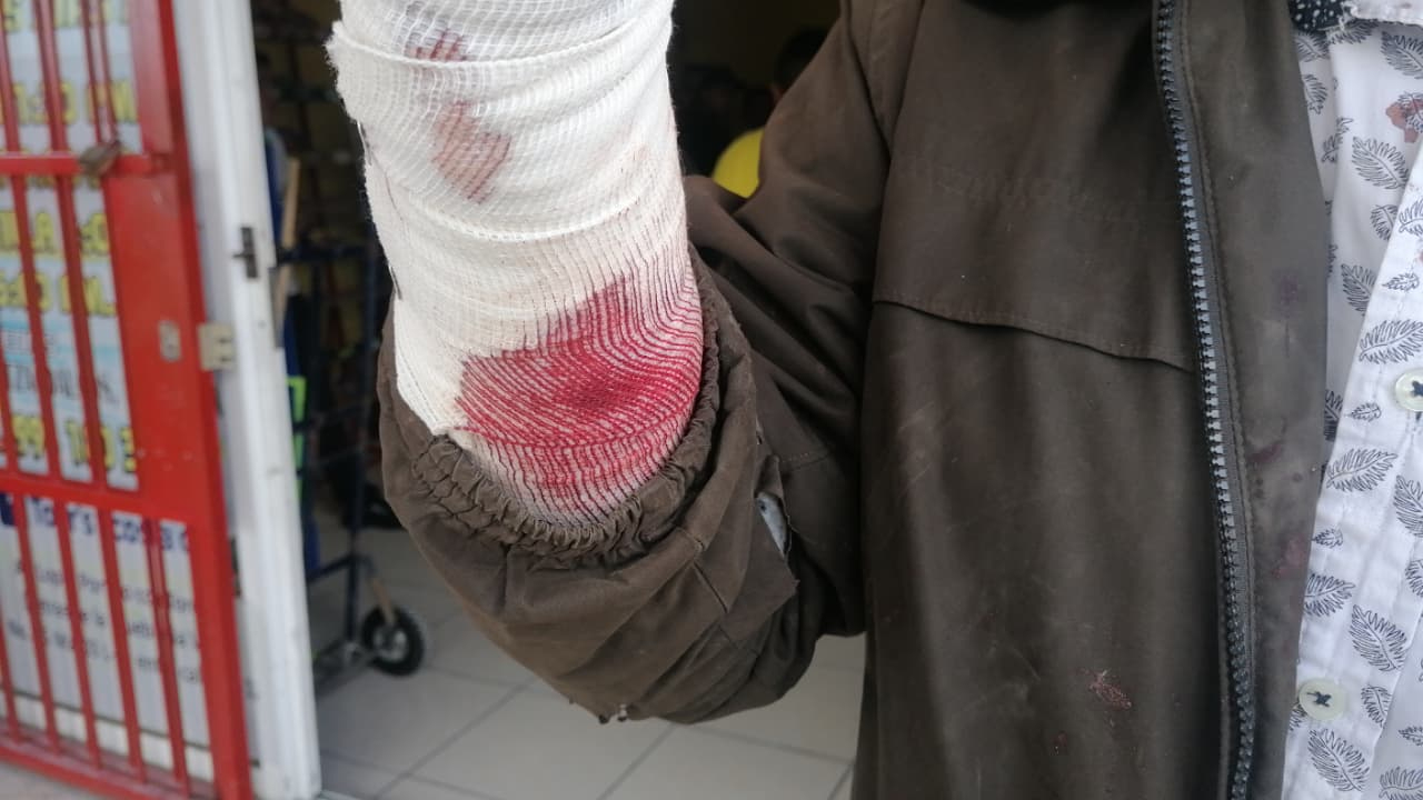 Los afectados solo recibieron pases médicos y esperan una indemnización o apoyo.