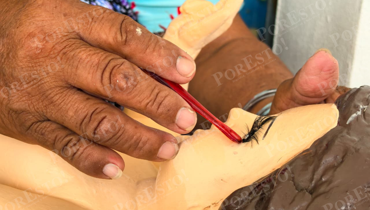 Los daños más comunes son dedos, manos y pies por el uso de yeso.