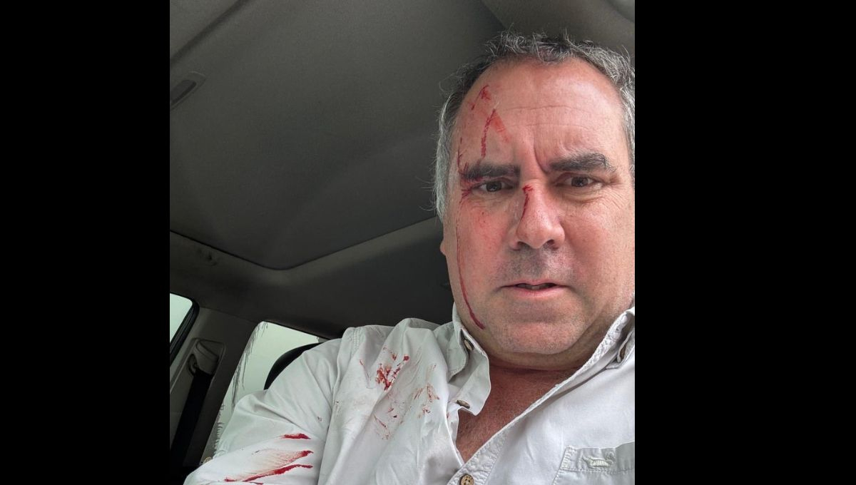 El vehículo recibió tres impactos de bala, aunque ninguno alcanzó directamente al precandidato, Rafael  Belaúnde