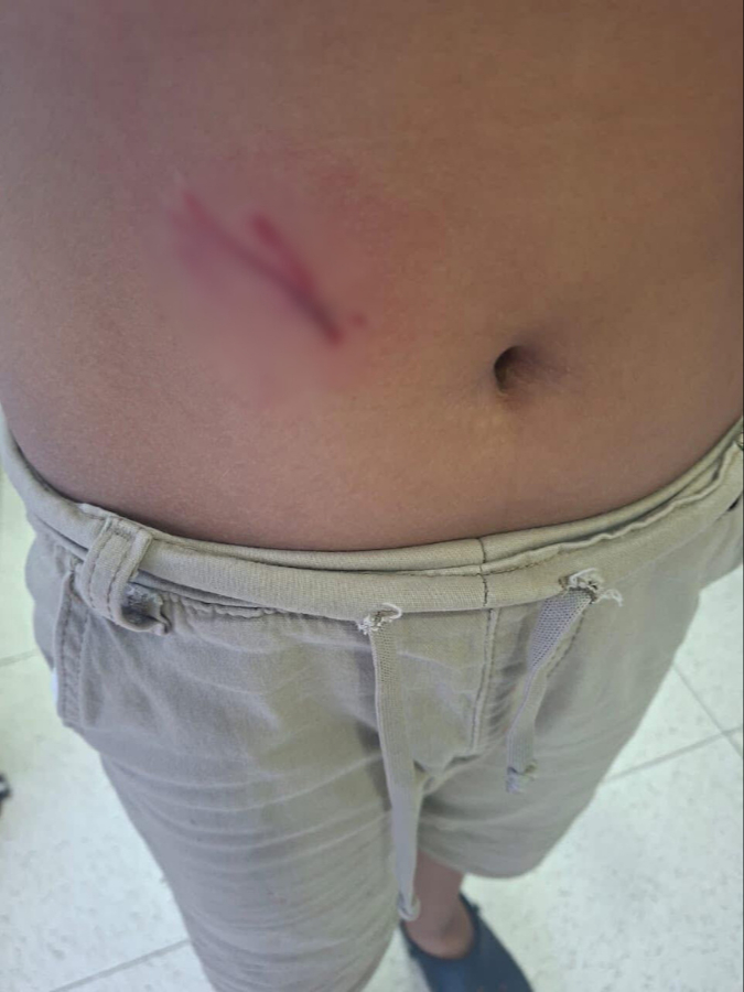 Los dueños del can dijeron no hacerse responsables