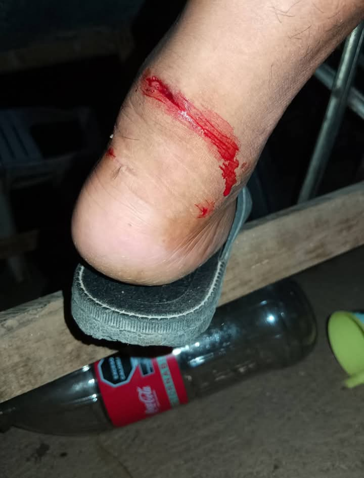 Ciudadano es mordido por perrita Ciudadano es mordido por perrita