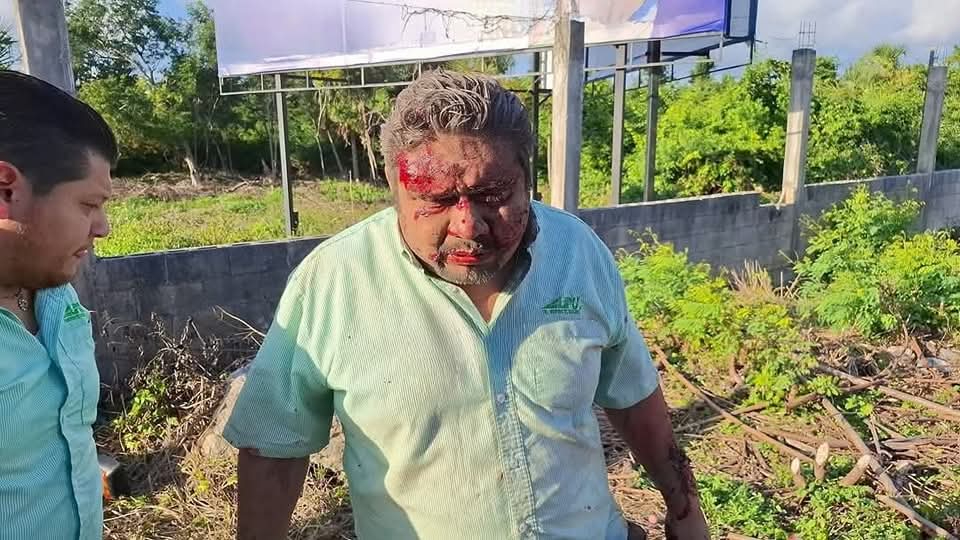 Autobús que transportaba a colaboradores del hotel Bahía Príncipe sufrió un aparatoso accidente Autobús que transportaba a colaboradores del hotel Bahía Príncipe sufrió un aparatoso accidente