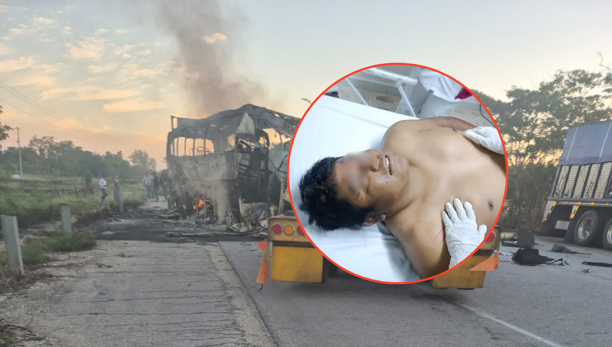 Raymundo Hipólito González, de 31 años, es sobreviviente del accidente en la carretera Escárcega-Villahermosa Raymundo Hipólito González, de 31 años, es sobreviviente del accidente en la carretera Escárcega-Villahermosa