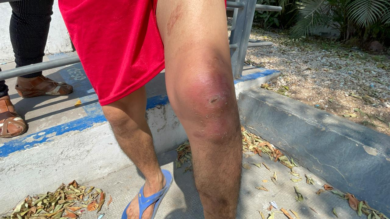 Los padres descubrieron las lesiones tras recibir videos que mostraban a los jóvenes en aparentes buenas condiciones Los padres descubrieron las lesiones tras recibir videos que mostraban a los jóvenes en aparentes buenas condiciones