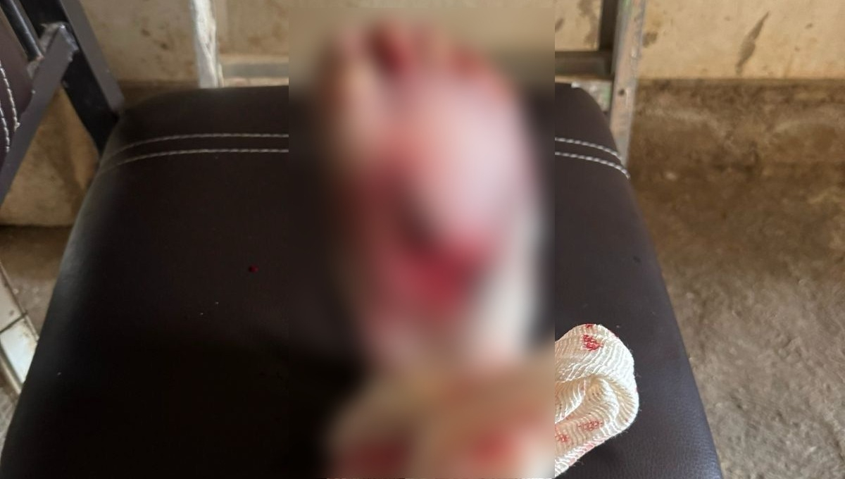 El hombre fue ingresado al hospital O'Horán de Mérida El hombre fue ingresado al hospital O'Horán de Mérida