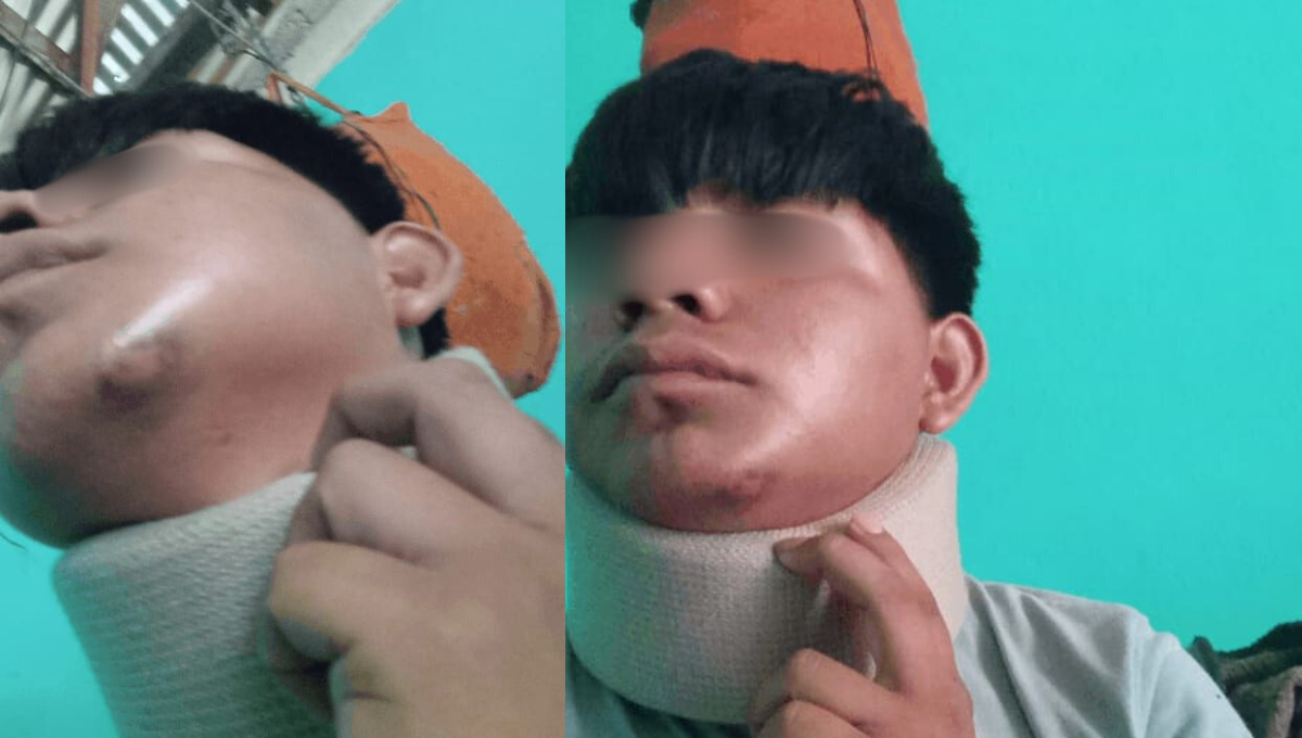 El joven fue trasladado al hospital IMSS-Bienestar para ser atendido por heridas en el cuerpo y cara El joven fue trasladado al hospital IMSS-Bienestar para ser atendido por heridas en el cuerpo y cara