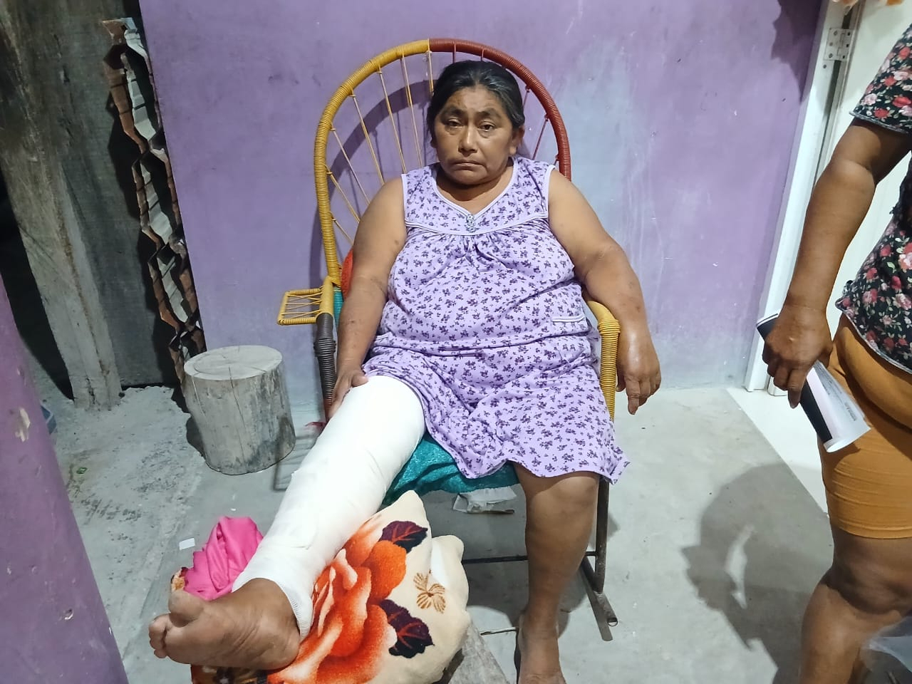Mujer sufre grave fractura en Escárcega y clama ayuda para pagar operación