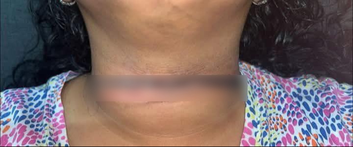 La mujer resultó lesionada en el cuello debido al cable colgado