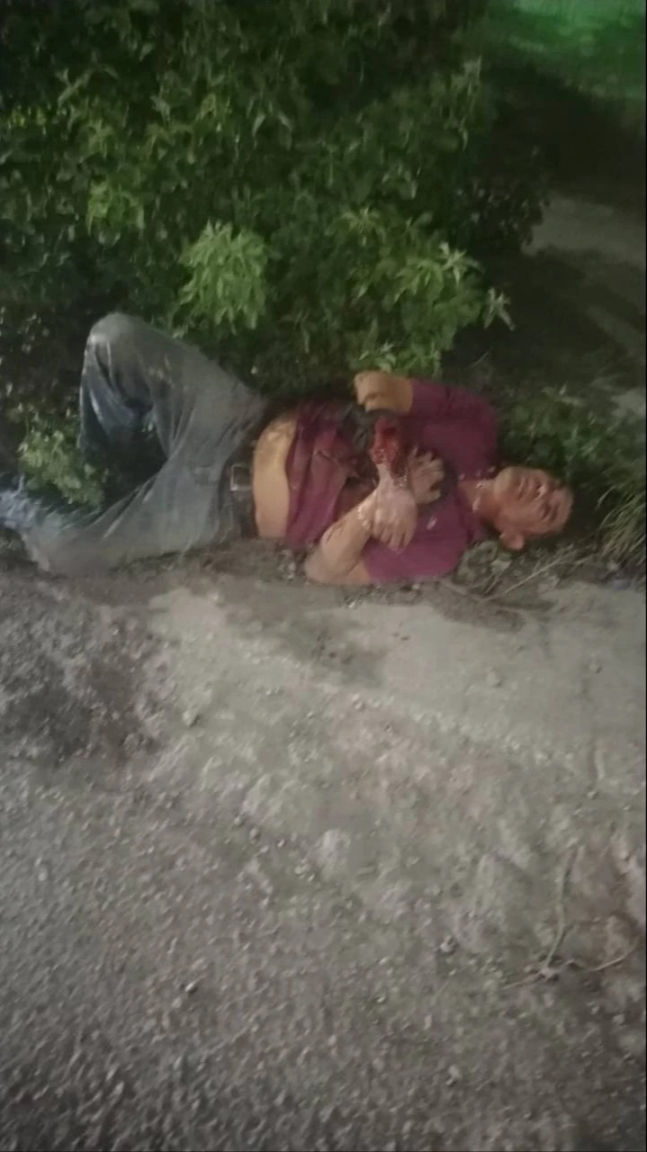 Doble ataque armado en Paseos del Mar y Haciendas del Caribe Doble ataque armado en Paseos del Mar y Haciendas del Caribe