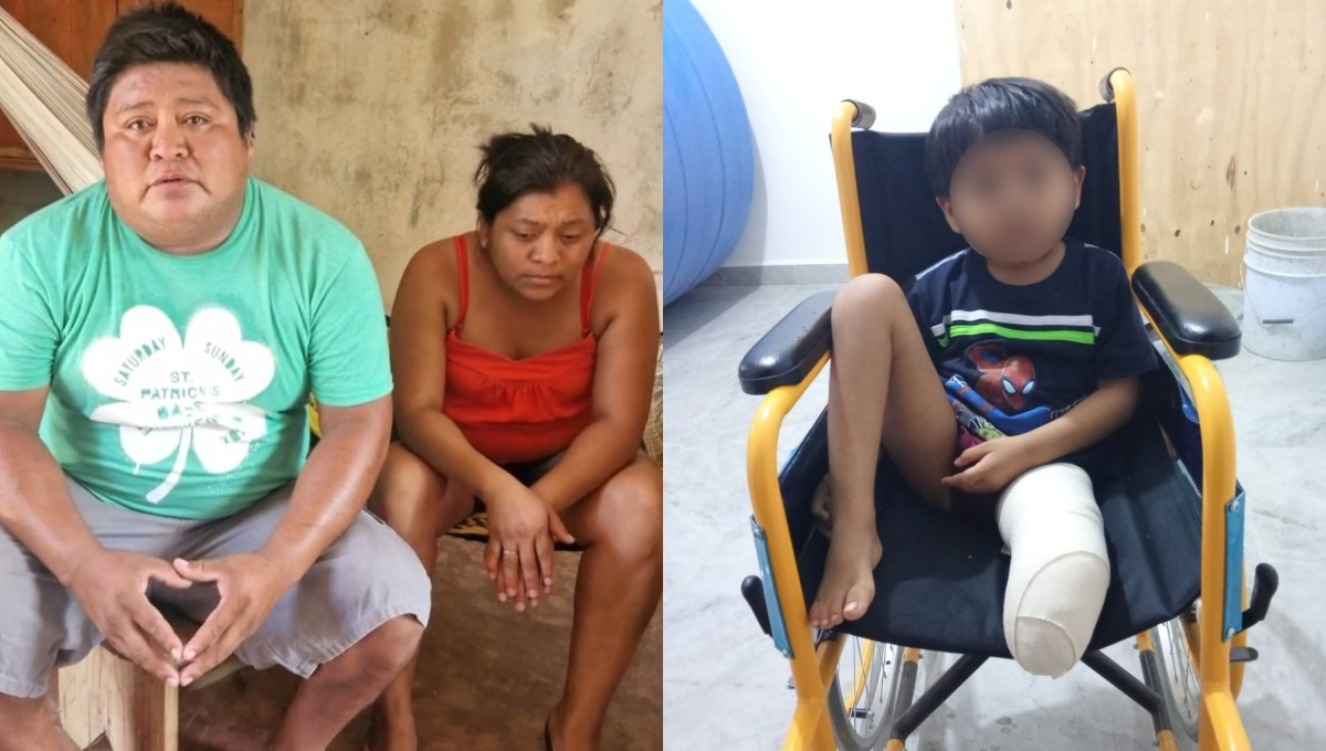 Yeremi podría perder por completo la pierna si no recibe una atención especializada Yeremi podría perder por completo la pierna si no recibe una atención especializada